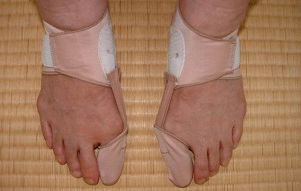 BOCHIKUN® Hallux Valgus Orthese Single Edition