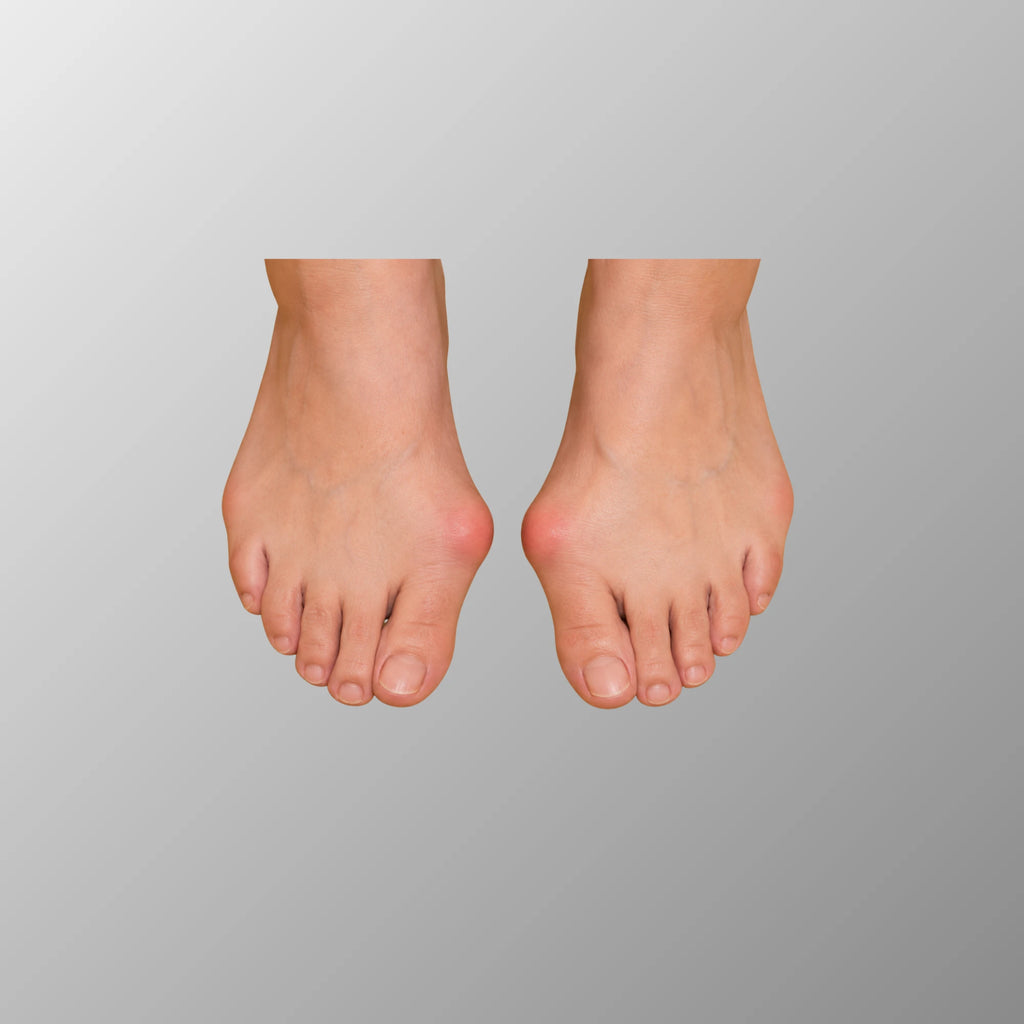 BOCHIKUN® Hallux Valgus Orthese Single Edition