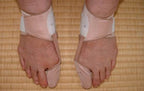 BOCHIKUN® Hallux Valgus Orthese Single Edition
